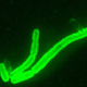 Image for article titled A Child in Los Angeles Has the Plague